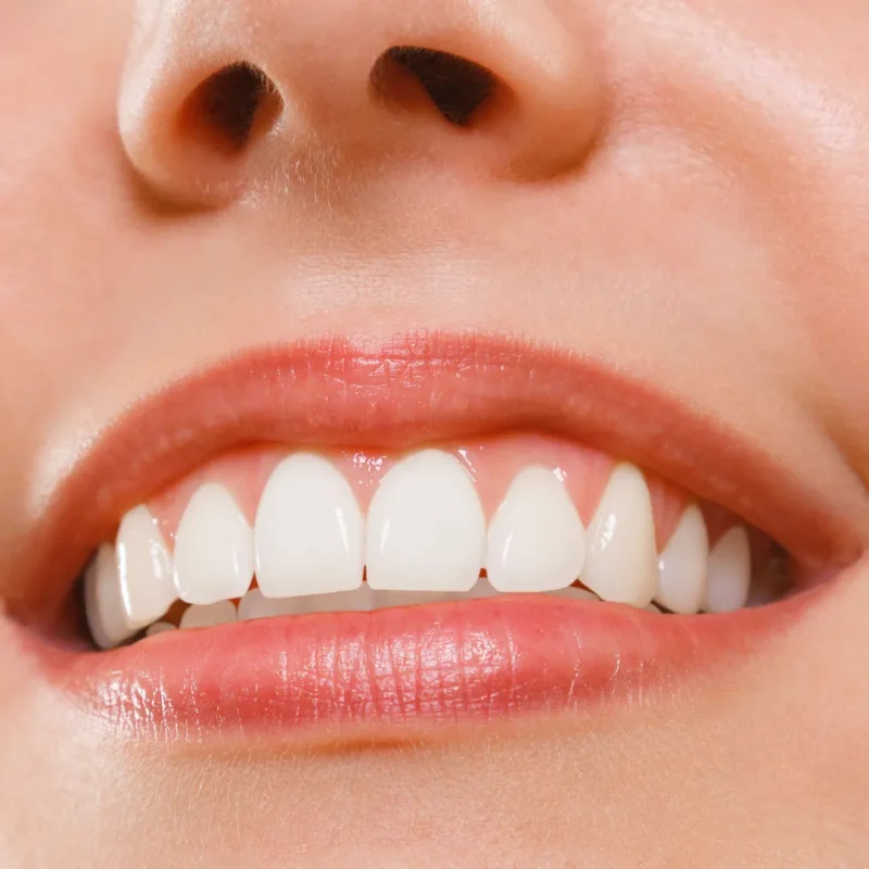 تاثیرات مواد با خواص اسیدی بر ایمپلنت فوری دندان