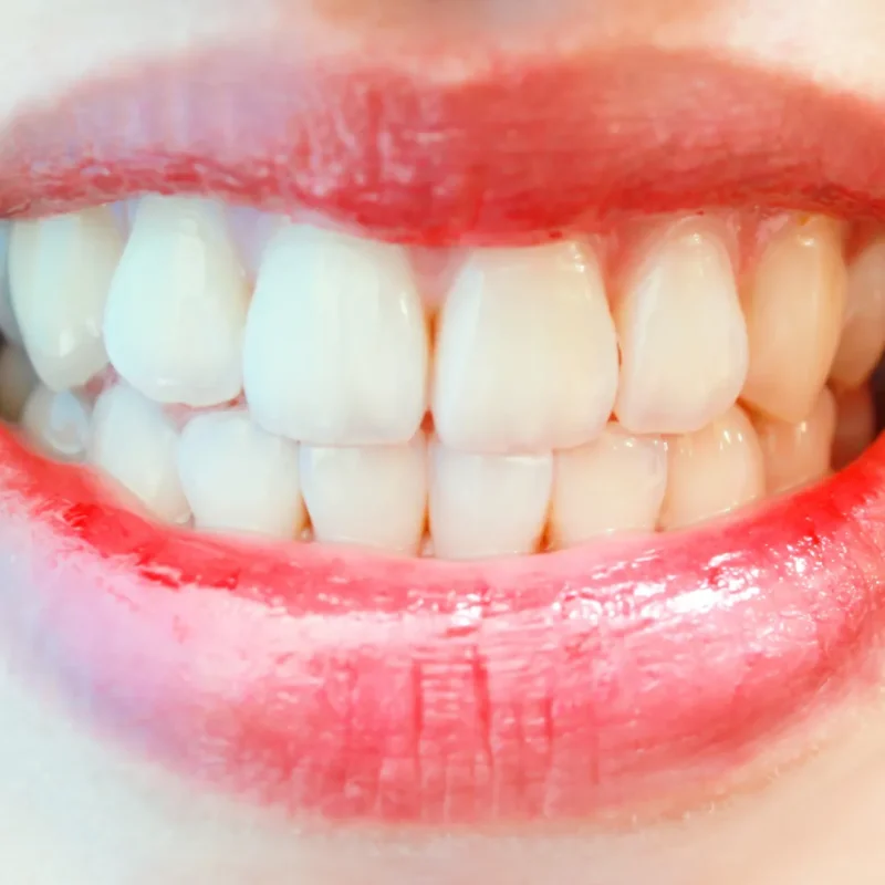 تاثیرات مواد با خواص اسیدی بر دندان مصنوعی