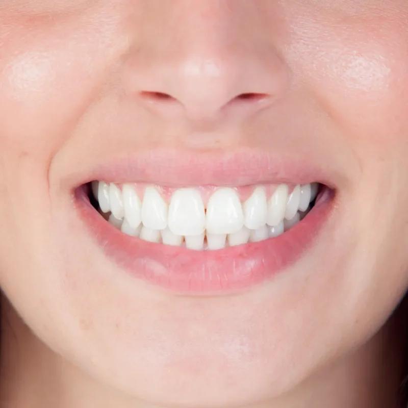 تاثیرات مواد با خواص اسیدی بر ایمپلنت یک روزه دندان