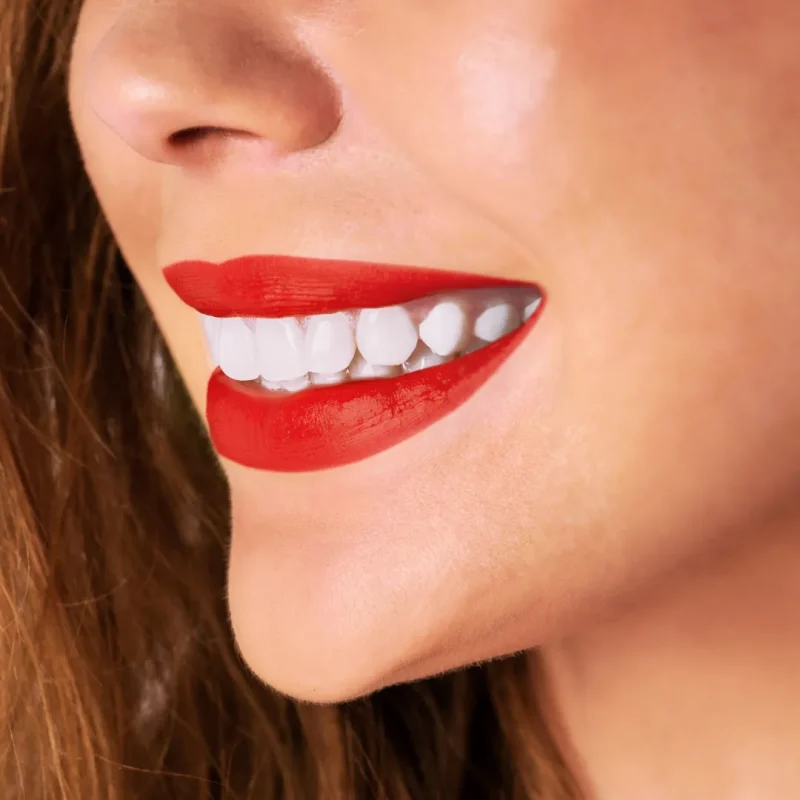 تاثیرات مواد با خواص اسیدی بر کامپوزیت دندان