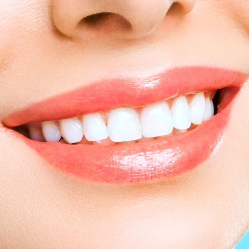 تاثیرات مواد با خواص اسیدی بر ایمپلنت دندان