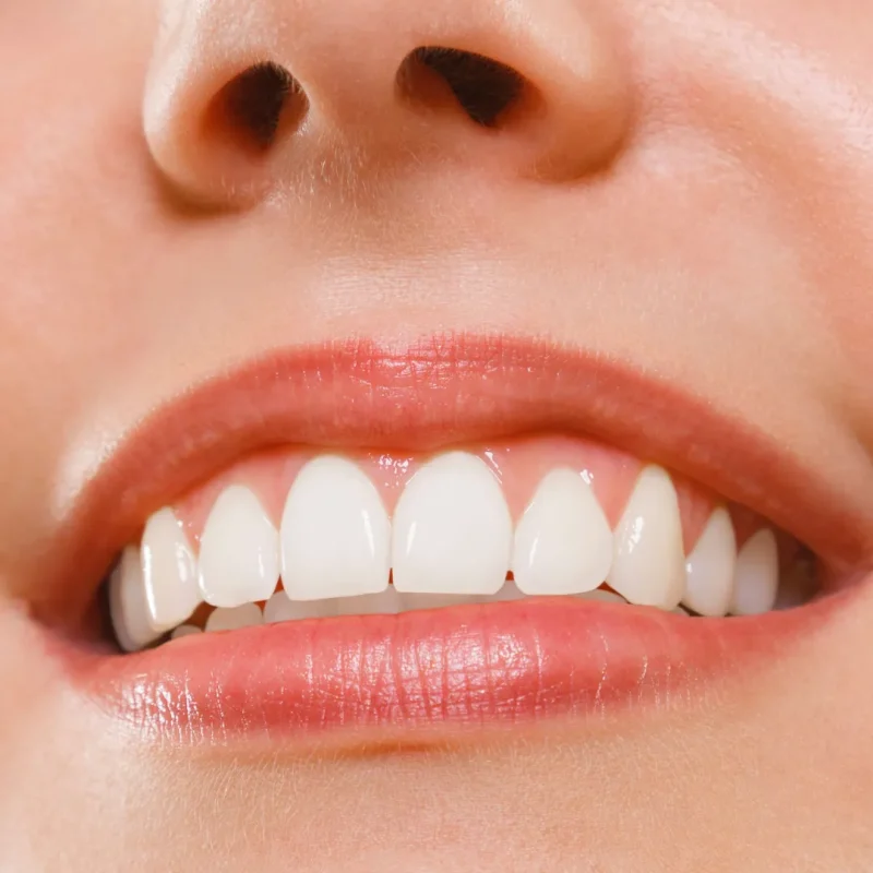 تاثیرات مواد با خواص اسیدی بر ایمپلنت دندان