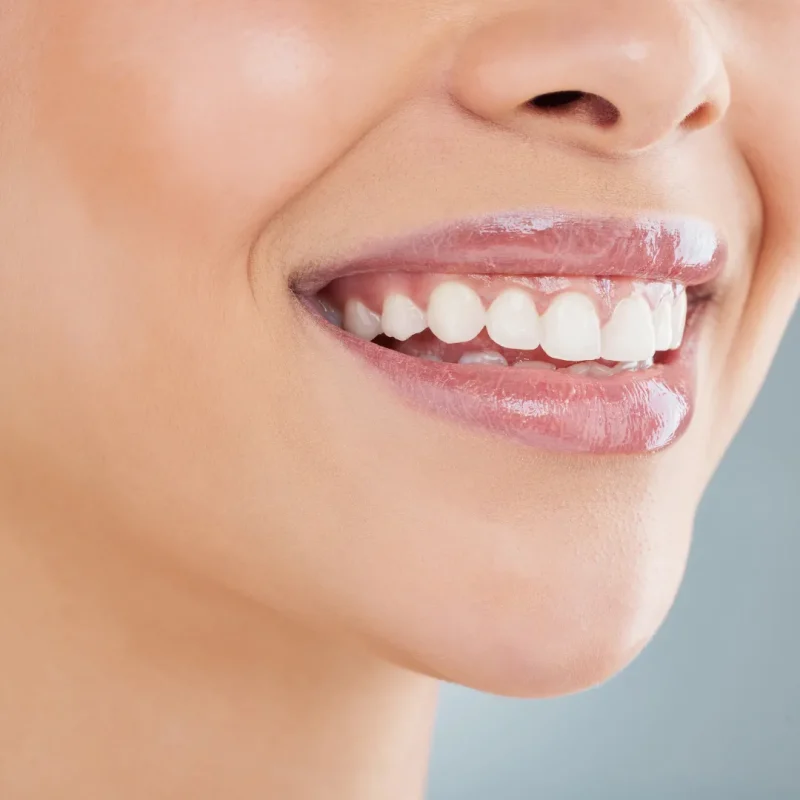 تاثیرات مواد با خواص اسیدی بر عصب کشی فوری دندان
